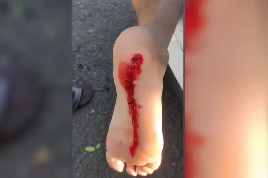Mais de 10 pessoas são socorridas após ataque de piranhas em prainha de Pereira Barreto