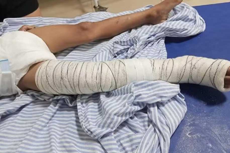 Criança de 5 anos é atropelada por motociclista que fugiu sem prestar socorro em Ilha Solteira