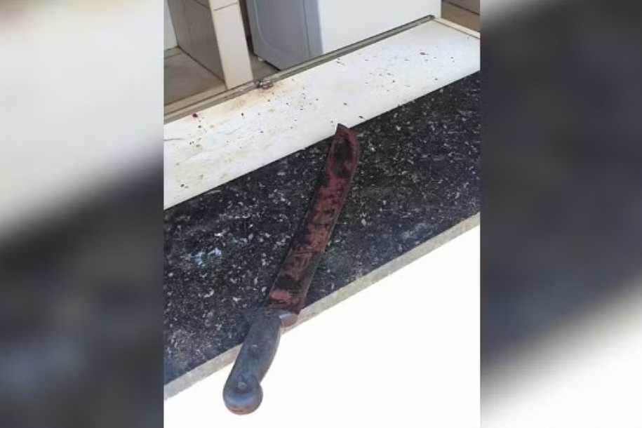 Mulher atacada pelo filho com facão e abandonada na piscina da casa da família tem parte do braço amputado no interior de SP