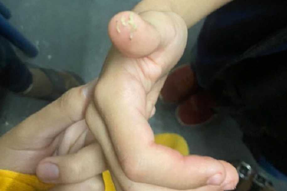 Alunos de escola estadual de Votuporanga encontram larvas na merenda