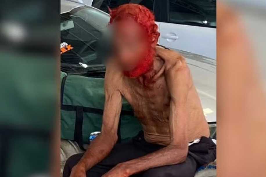 Idoso em situação de rua tem cabelos e barba tingidos de vermelho por empresário em troca de doações