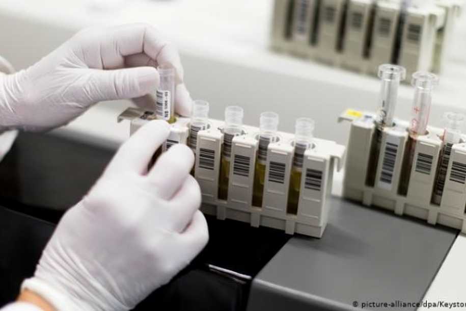 Pesquisa brasileira diz ter eliminado HIV de paciente soropositivo