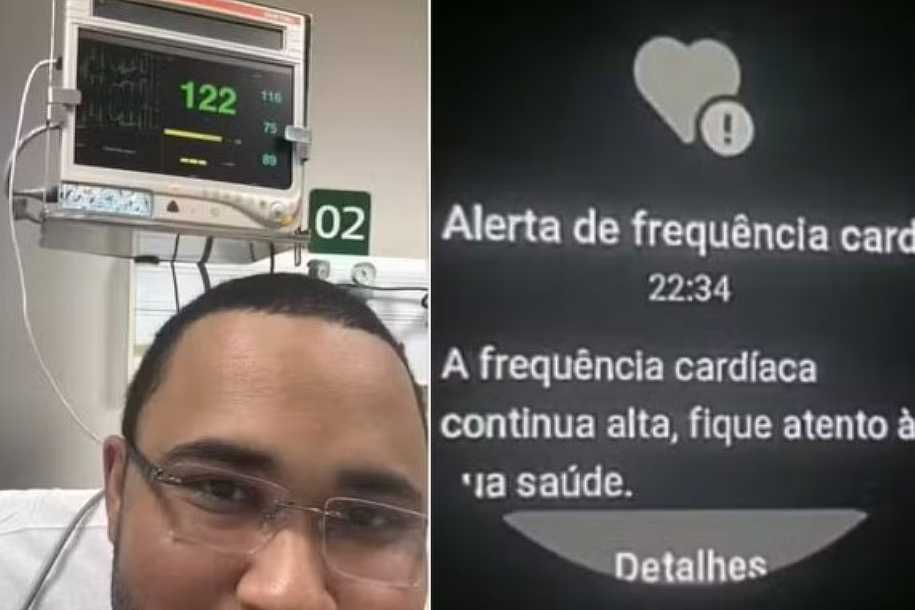 Após alerta em relógio levar analista de 35 anos para UTI, médico reforça que arritmias também atingem jovens