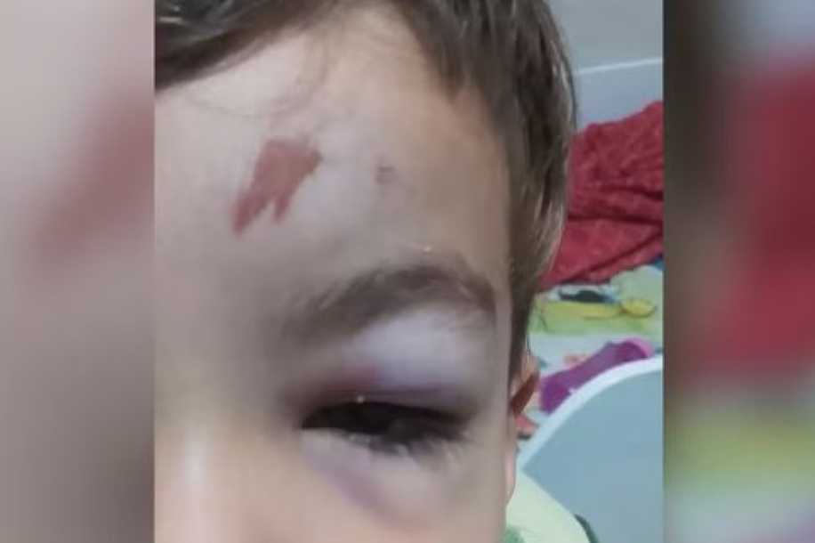 Mãe paga tomografia após criança bater a cabeça, vomitar e esperar quase 48 horas por vaga na Santa Casa de Araçatuba