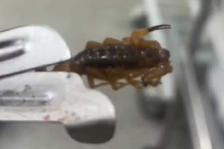 Bebê de 9 meses é picada por escorpião em casa e mãe denuncia vizinhança por sujeira e mato alto: ´Quase vi minha filha morrer´