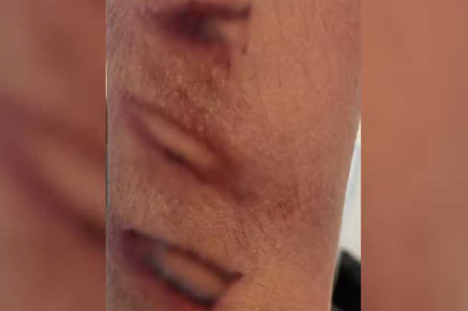 Homem é preso por maus-tratos após espancar enteado com pedaço de mangueira