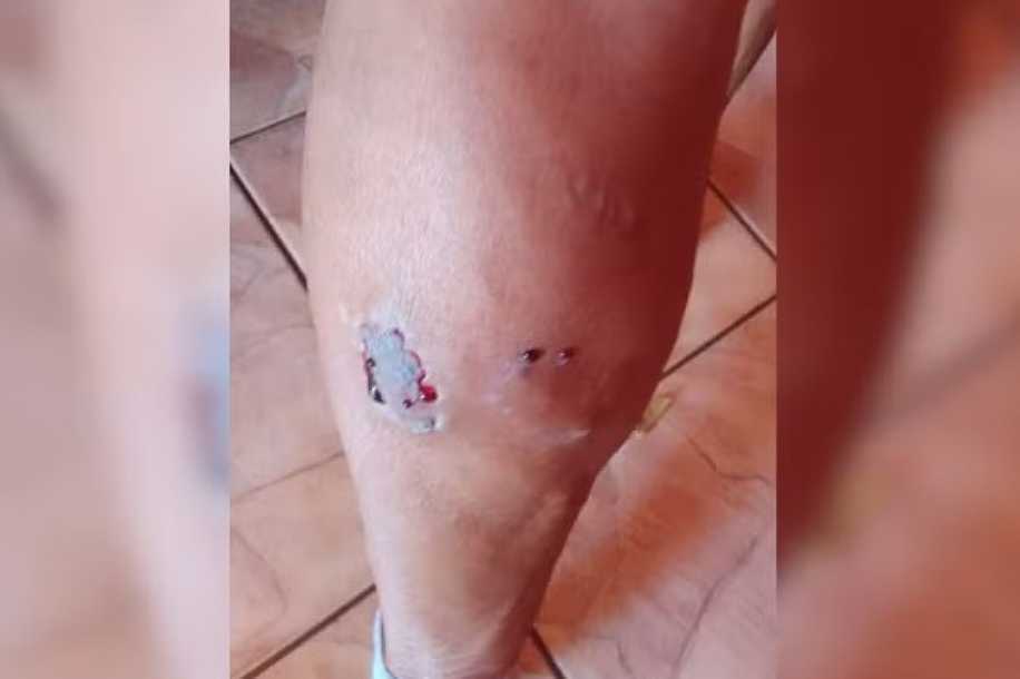Idosa fica ferida após ser mordida por cão do vizinho em cidade do interior de São Paulo