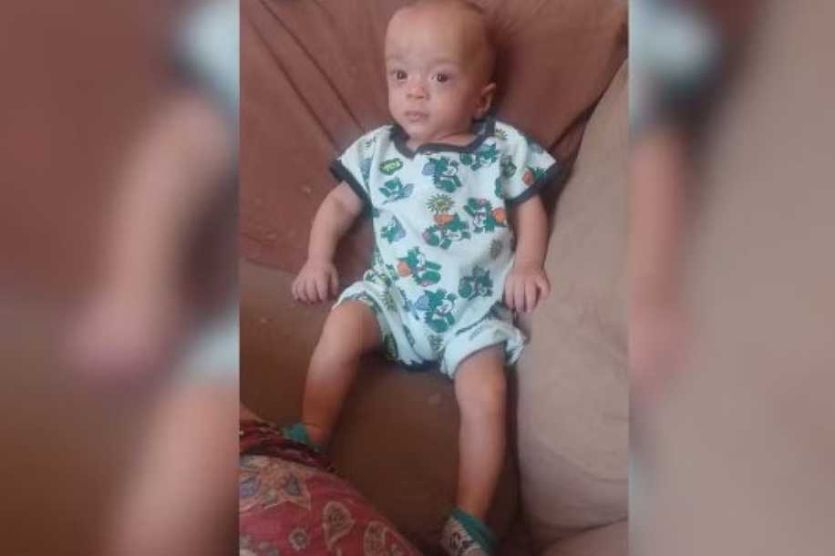 Menino de 3 anos luta contra avanço da escoliose após nascer com 670 gramas: ´Ele é meu tudo´, diz mãe