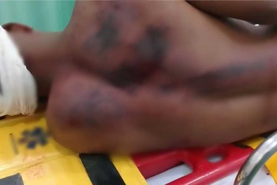 Padrasto preso por espancar enteado de 17 anos com pedaço de madeira já tentou matar mãe da vítima a facadas