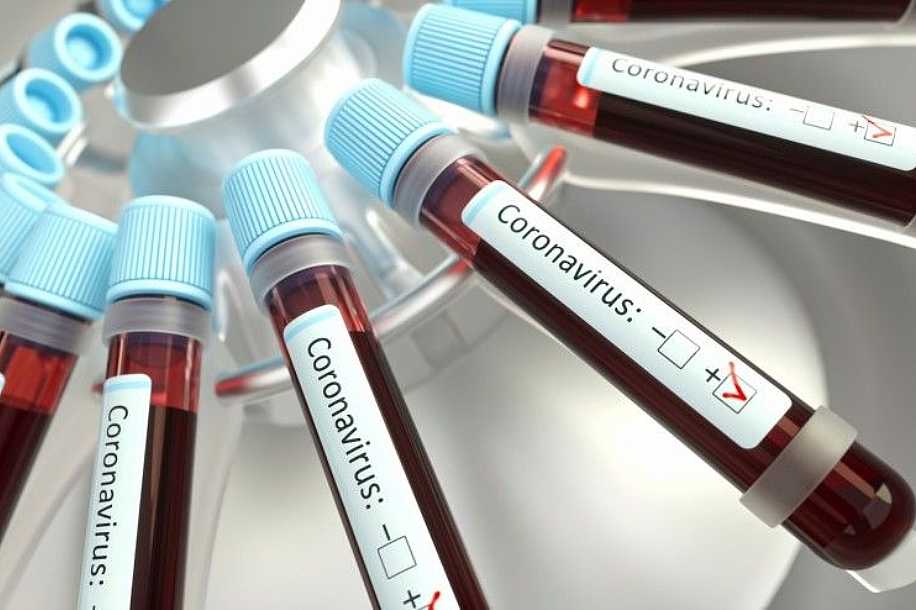 Rio Preto ultrapassa a marca de mil mortes por covid-19 e vê crescimento na taxa de ocupação em UTIs