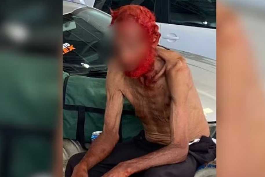 Empresário é indiciado por tingir cabelos e barba de idoso em situação de rua