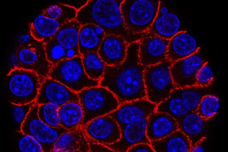Cientistas desenvolvem exame capaz de detectar 5 tipos de câncer precocemente