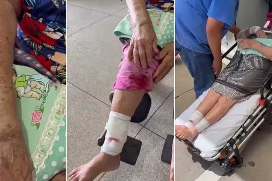 Idosa é atacada por cão que estava solto em rua de Riolândia