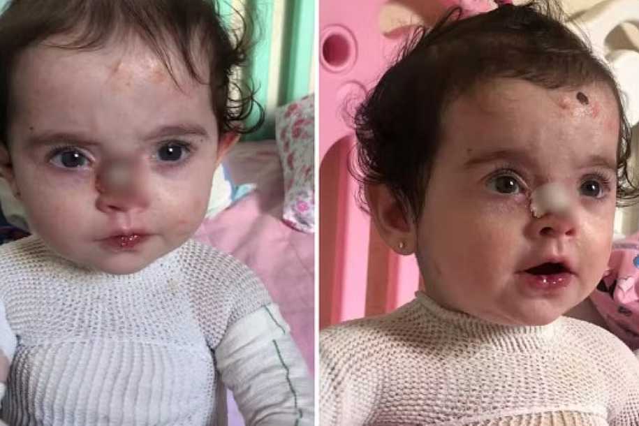 Polícia investiga suspeitos de usarem fotos de criança com doença rara para arrecadar dinheiro