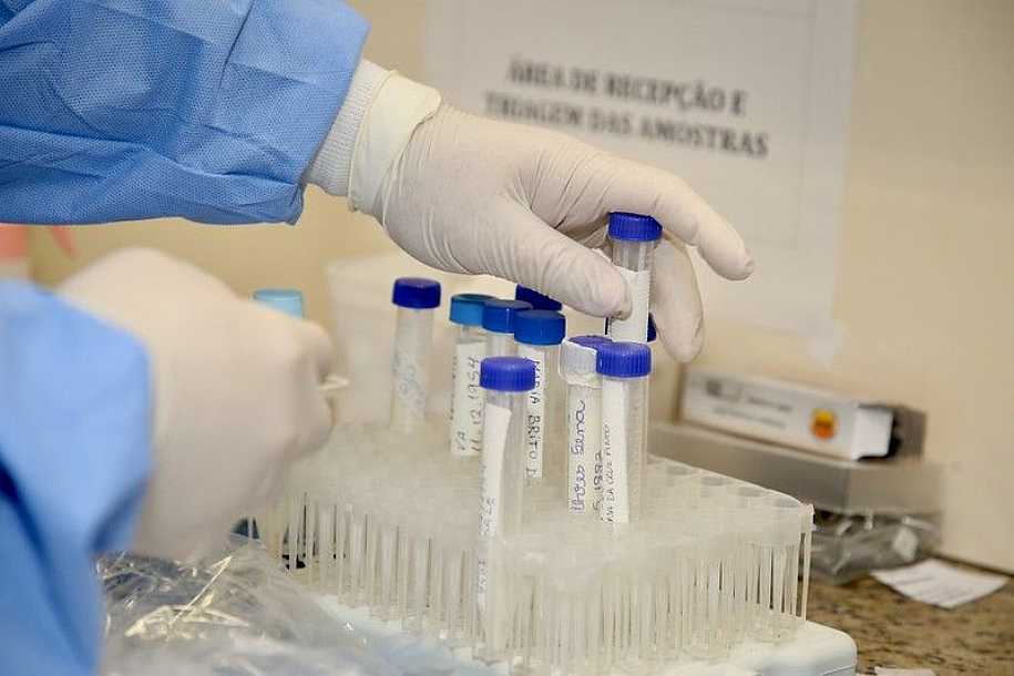 Anvisa muda regras para uso emergencial de vacinas contra a covid-19