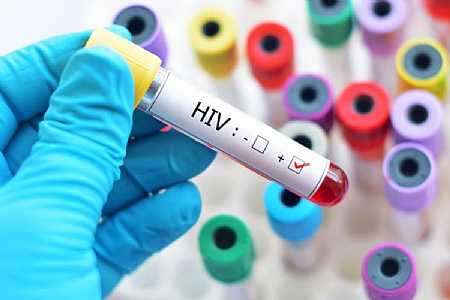 Mortalidade por Aids cai 39% no Estado de São Paulo na década