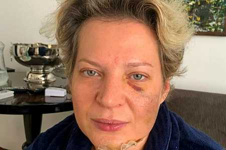 Laudo da Polícia do DF não aponta ´lesões recentes´ no corpo de marido de Joice
