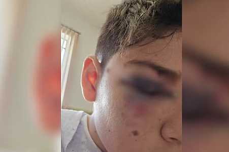 Estudante leva três pontos no rosto após ser agredido por um colega de sala dentro de escola no interior de SP