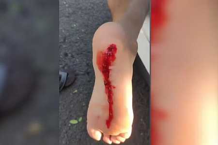 Mais de 10 pessoas são socorridas após ataque de piranhas em prainha de Pereira Barreto