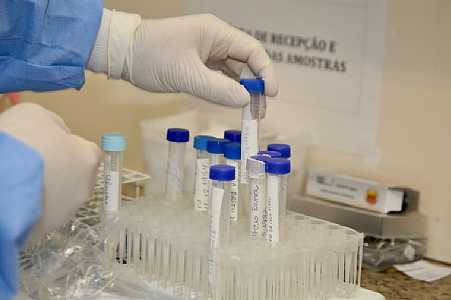 Anvisa autoriza farmacêutica a realizar estudo fase 3 de medicamento contra covid