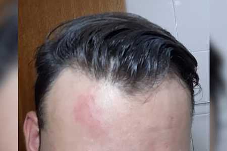 Aluno suspeito de agredir professor que sofreu traumatismo craniano é transferido de escola