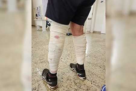 Idoso fica ferido ao ser atacado por cães em Rio preto