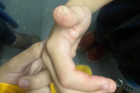 Alunos de escola estadual de Votuporanga encontram larvas na merenda