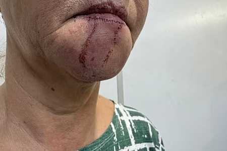 Passageiro é preso suspeito de assediar e agredir mulher com soco no rosto dentro de ônibus