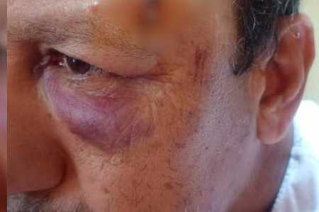 Tropeiro leva coice de boi na cabeça durante rodeio, desmaia e fala em ´milagre´: ´Nunca vi algo parecido´;