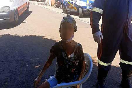 Homem preso suspeito de despejar litros de cola de sapateiro na esposa ganha liberdade provisória