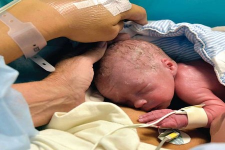 Mulher que recebeu transplante de útero dá à luz na Suécia