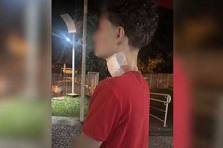 Motociclista recebe 35 pontos no pescoço após ser atingido por linha com cerol em bairro de Rio Preto