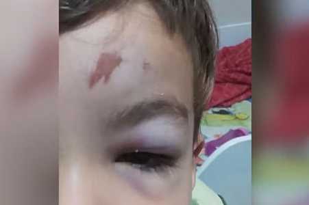 Mãe paga tomografia após criança bater a cabeça, vomitar e esperar quase 48 horas por vaga na Santa Casa de Araçatuba