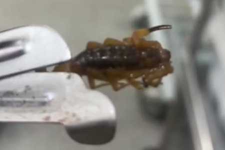 Bebê de 9 meses é picada por escorpião em casa e mãe denuncia vizinhança por sujeira e mato alto: ´Quase vi minha filha morrer´