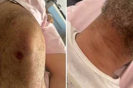 Advogado espancado por seguranças em saída de rodeio comemorava aniversário de relacionamento