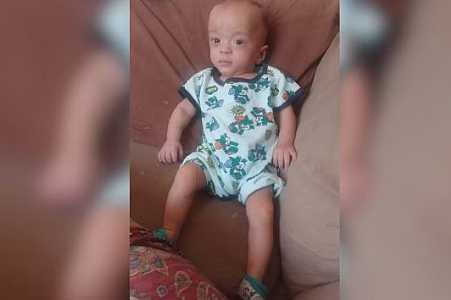 Menino de 3 anos luta contra avanço da escoliose após nascer com 670 gramas: ´Ele é meu tudo´, diz mãe