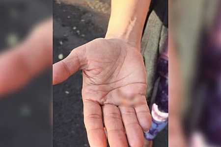 Mulher tem pedaço da orelha arrancada com mordida do ex-companheiro em Rio Preto
