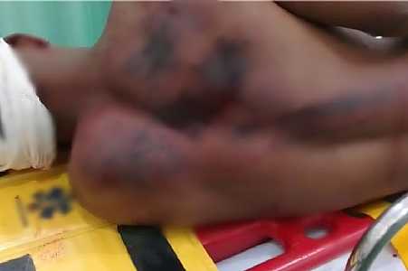 Padrasto preso por espancar enteado de 17 anos com pedaço de madeira já tentou matar mãe da vítima a facadas