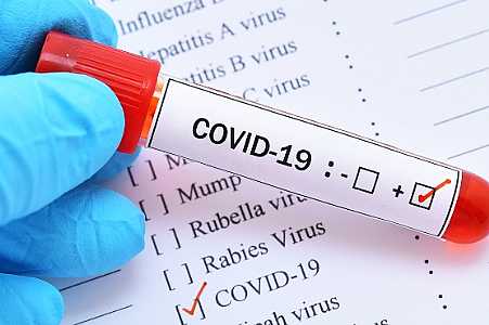 Brasil deve ter acordo para vacina contra a covid-19 de Oxford