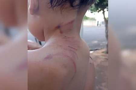 Mulher grávida e filho de 3 anos são atacados na rua por cachorro no interior de SP