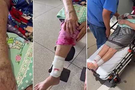 Idosa é atacada por cão que estava solto em rua de Riolândia