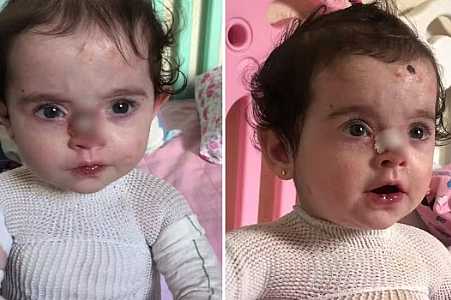 Polícia investiga suspeitos de usarem fotos de criança com doença rara para arrecadar dinheiro
