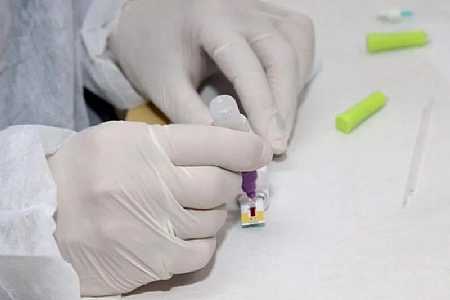Brasil tem 15,7 mil novos casos e 537 mortes em 24 horas