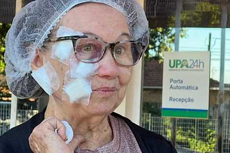 VÍDEO: Idosa leva 50 pontos no rosto após ser atacada por pit bull no interior de SP