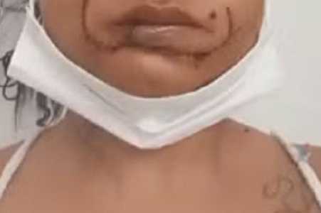 Suspeito de agredir e tirar pedaço do lábio da ex se entrega na Polícia Civil