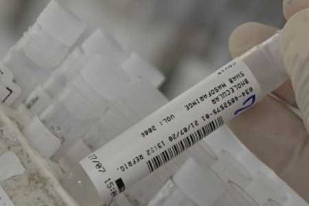 Covid-19 pode diminuir tamanho do pênis, diz estudo