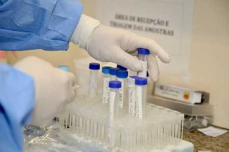 Anvisa muda regras para uso emergencial de vacinas contra a covid-19