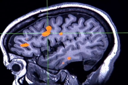 Memória no cérebro é gerada em 300 milésimos de segundo, diz estudo