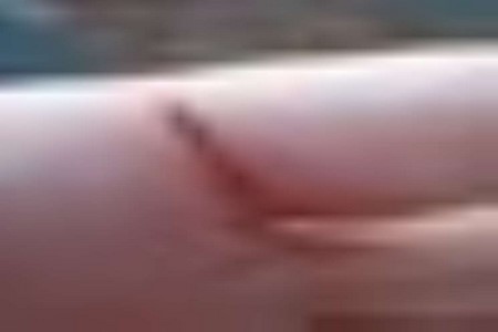 Motociclista fica ferida após ser atingida por linha com cerol em Rio Preto